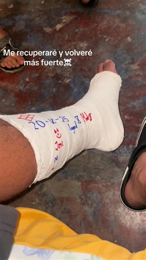 #fractura #fyp #pagaras_lo_que_hiciste …..