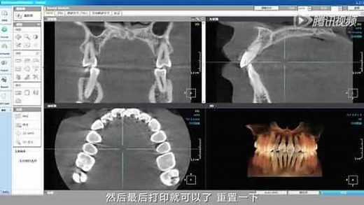 Ondemand 3D dental软件教学视频01 基本功能