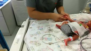 新生儿桡动脉采血新定位方法