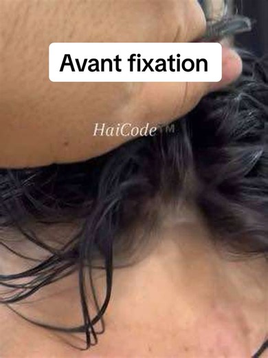 🎥 Tu crois que c’est ses vrais cheveux ? On l’a enlevée. Et le hairline est toujours parfait. Bienvenue dans la nouvelle ère de la prothèse capillaire. Pas de greffe. Pas de cicatrices. Juste un résultat invisible, naturel, immédiat. ✨ Hair system nouvelle génération ✨ Prothèse capillaire haut de gamme ✨ Alternative à la greffe capillaire en Turquie ✨ Solution pour calvitie, chute de cheveux, zone donneuse faible ✨ Résultat conçu pour durer – même de très près 🇩🇿 Pensé pour les Algériens de F