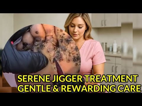 Serene Jigger Treatment | Gentle & Rewarding Care