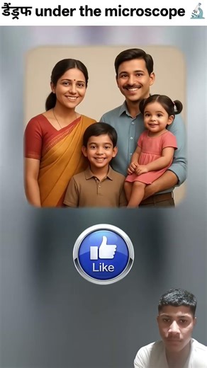 Dandruff Under The Microscope 🤯🔬🤢 #ytshorts #trendingshorts #shorts #trending #viral #shortvideo