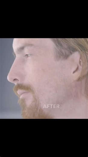 21K views · 351 reactions | 400 TUMORS REMOVED | AMAZING TRANSFORMATION after Surgery #pimplepopper #drpimplepoppers #cyst #cystremoval #doctor #surgery #disease #plastic #hospital #pimplepopping #cyst #cystremoval #pimplepopping #skincareroutine #blackheadremoval #satisfyingvideos #cancer #tumors #cancersurvivor | Fail Army | Facebook