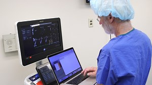 Noninvasive Determination of Vortex Formation Time Using Transesophageal Echocardiography During Cardiac Surgery