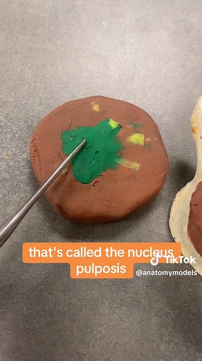 Intervertebral Disc Model #anatomymodel #STEMtok #STEM #anatomy #professorkleinanatomy #anatomymodels #learnontiktok #humananatomy #spine #herniateddisc #slippeddisc #backpain #back