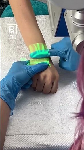 This Machine Makes Finding Veins Easy