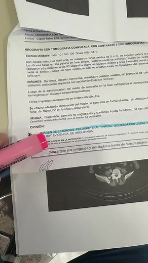Riñón tapado: causas y tratamiento quirúrgico