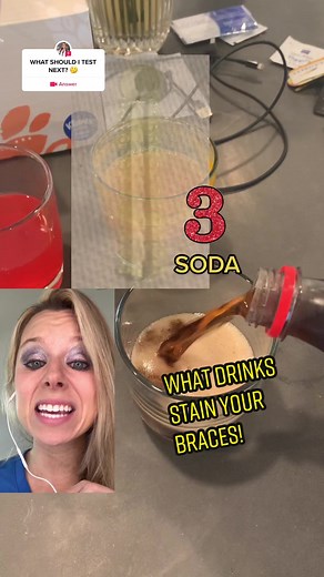 Discover What Drinks Stain Your Braces! Avoid Turmeric at All Costs