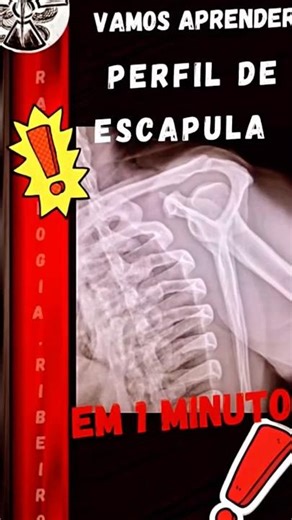 🚨X-RAY OF SCAPULA PROFILE - Y + NIER IN 1 MINUTE - SUBTITLED 📸✨