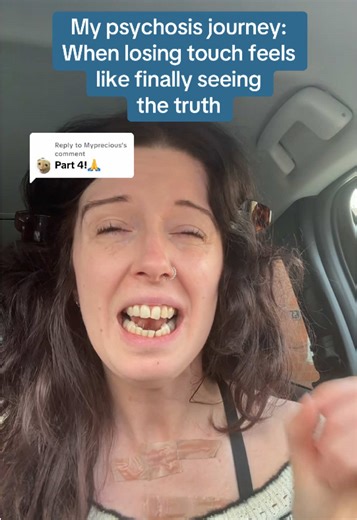 Understanding My Psychosis Journey: A Personal Story