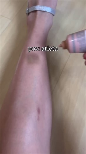 SoccerGirl on Instagram: "Never not bruised"