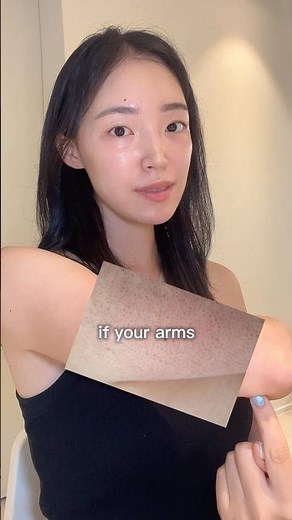 it’s called Keratosis Pilaris (or ‘strawberry skin’). try this effective 3-step routine