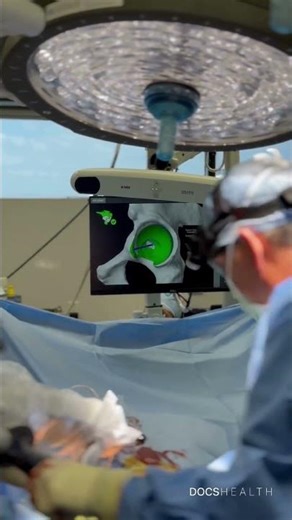 Hip Replacement Surgery | Shaping the Socket & Placing the Implant