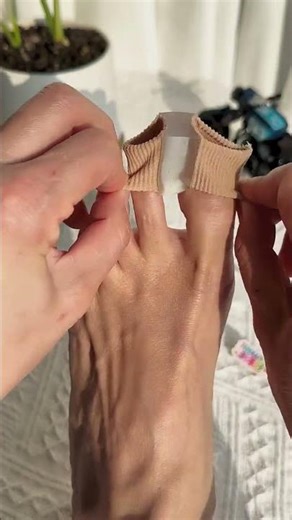 Advanced Toe Straightener 💙 | Gentle Bunion Relief Solution