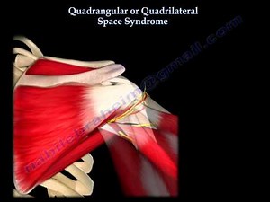 Quadrangular, axillary nerve injury Everything You Need To Know - Dr. Nabil E