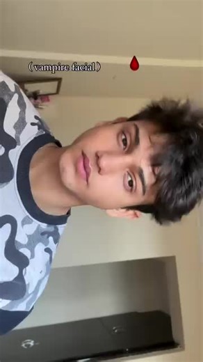 Vampire Facial for Smooth, Glowing Skin