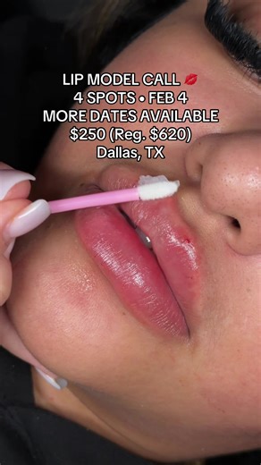 ✨ LIP MODEL CALL – DALLAS ✨ Looking for 4 lip models on Feb 4 for a live training class (other providers will be observing). More model dates available on other days. 💉 $250 model rate (reg. $620) 📍 Dallas, TX DM MODEL for details 💌 #lipinjections #modelcall #dallas #dallasinjector