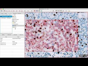 Cell Classification using QuPath