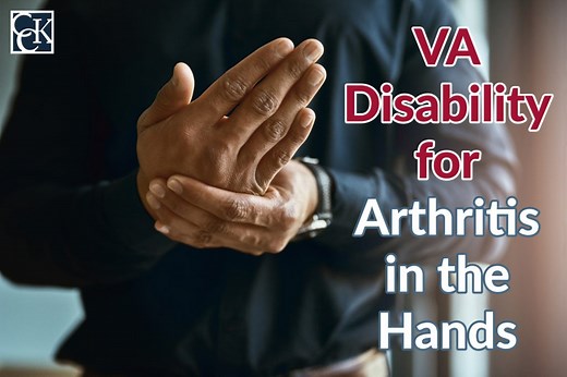 VA Disability for Arthritis in the Hands | CCK Law