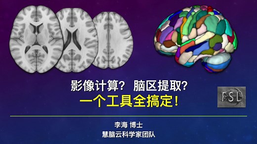 慧脑云｜脑影像分析的实用小工具(FSL篇)