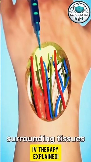 iv therapy explained | nursing tips