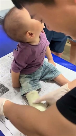 Look what he did while the cast was being removed! ❤️🥰
