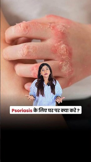 Psoriasis Precautions at Home | Skincare, Diet & Lifestyle Tips by Dermatologist
