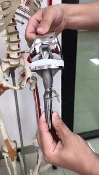 HRSK Hinged Knee System produced by JUST Medical.