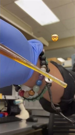 Blood sample from an alcoholic 🍺🩸 #science #healthcare #medicallaboratoryscience