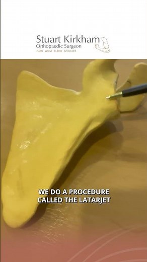 Labral Repair vs. Latarjet Surgery