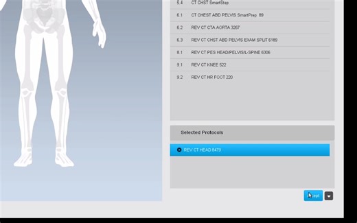 Revolution-新患者--扫描流程示例
