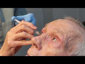 How to Irrigate Lacrimal System