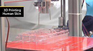 We can now 3D print functional human skin | Alex Klokus