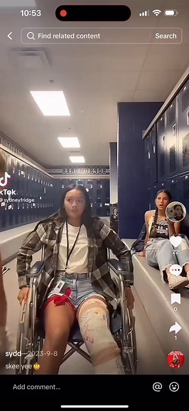 #longlegcast #fulllegcast #cast #casted #castedup #castedleg #legcast #brokenleg #crippled #cripple #prettygirl #feet #toes #fyp #whitecast #wheelchair