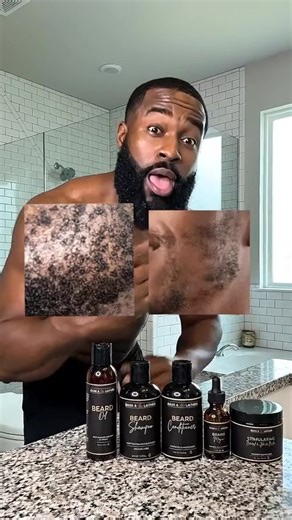 Men’s Healthy Hair and Beard Starter Kit Nourishing Shampoo, Conditioner, and Gentle Shea Butter Blend Balm Hydrating Set. Valentine's Day | Gift | Men's self-care #tiktokshop #ayisyentiktok🇭🇹 #tiktokshopcreatorpicks #tiktokshopfinds #TikTokShopStockUp