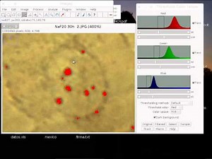 contarparticulasImageJ