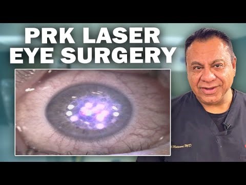 Photorefractive Keratectomy (PRK) Laser Eye Surgery