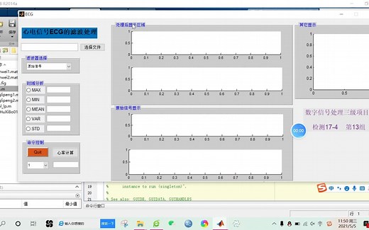 【心电信号】基于matlab ECG滤波【含Matlab源码 484期】