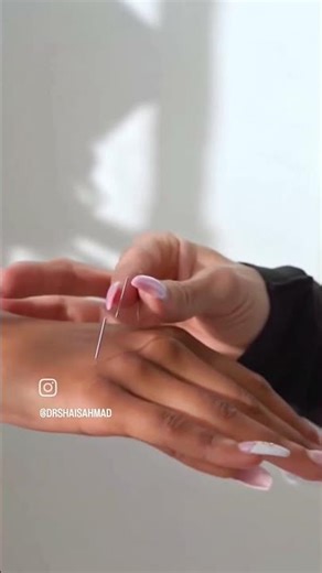 "Is Electro Dry Needling Better Than Regular Needling? #Recovery"