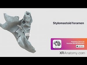 Temporal Bone - Stylomastoid foramen
