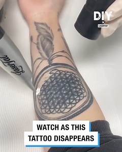 26K views · 17 reactions | It's good to know you can always get your tattoos removed if you end up making a big mistake!  | Do It Yourself | Facebook