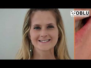 Master Digital Dentistry with Exocad Dental CAD | Full Overview