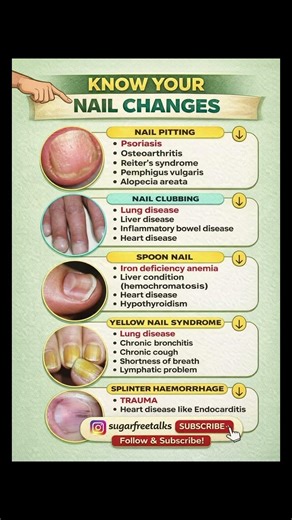 5 Nail Changes You Should NEVER Ignore | Nail signs of Disease #nail #nailhealth #shortsfeed