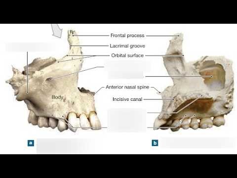 Anatomy of Maxillae; form the upper jaw and play a central role in the structure of the face