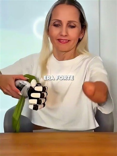 The prosthetic beat her son 💪