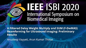 A Filtered Delay Weight Multiply and SUM (F-DwMAS) Beamforming for Ultrasound Imaging: Preliminary Results