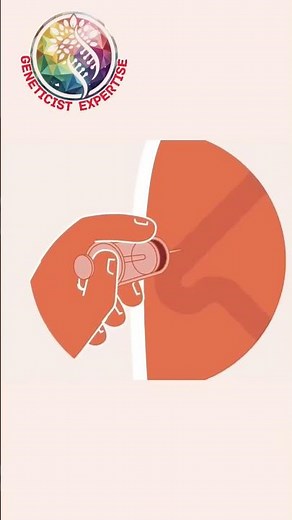 What is NIPT?