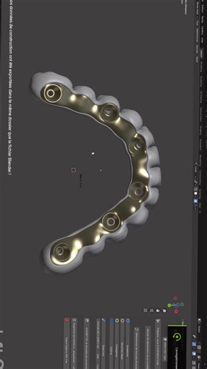 Construction ➡️I-Bar🦷👉🇹🇳@B4D #dentallab #fullarchimplant #dentalimplants #ibar