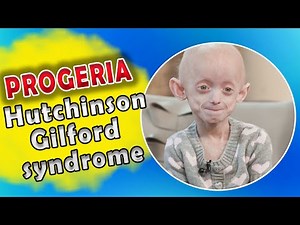 Genetic Disorder that causes you to grow Old Rapidly | Progeria | Hutchinson-Gilford syndrome