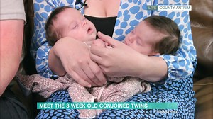 The sweetest little babies 🥺 We wish the Bateson family a happy and healthy road ahead ❤️ | This Morning